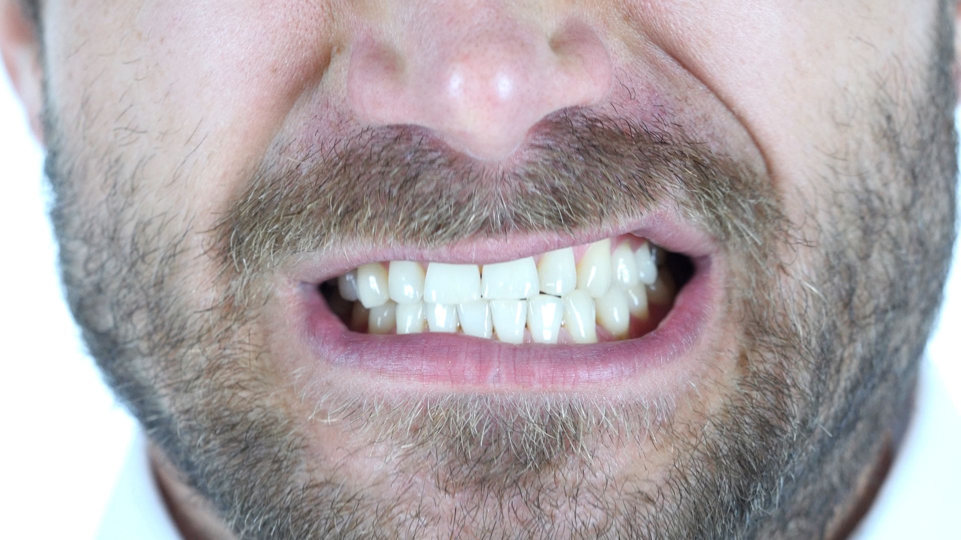How Does Teeth Grinding Cause Gum Recession GDG