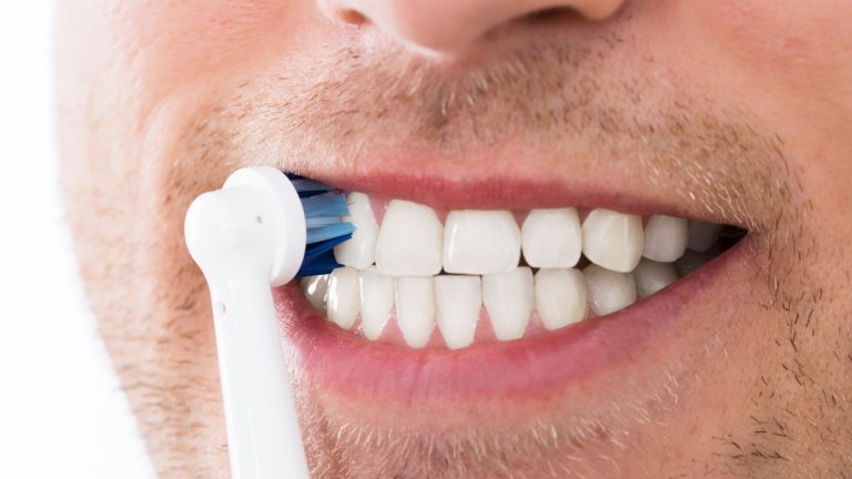 How to Prevent Gum Recession